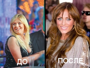 Похудевшие люди до и после